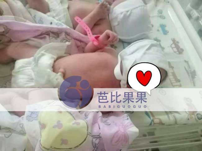 乌克兰马丽塔自卵试管双胞胎出生